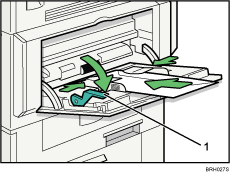 Die Abbildung zeigt den Bypass